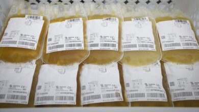 el-centro-de-transfusion-de-la-comunidad-de-madrid-potencia-la-donacion-de-plasma-como-unico-tratamiento-para-salvar-la-vida-de-6.000-madrilenos