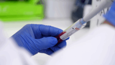 el-hospital-publico-12-de-octubre-participa-en-una-investigacion-que-utiliza-la-ia para-predecir-la-respuesta-a-inmunoterapia-en-cancer-de-pulmon