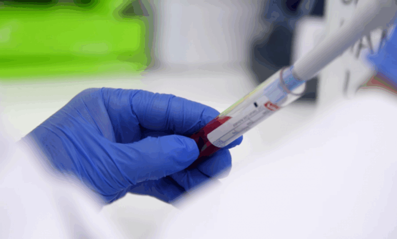 el-hospital-publico-12-de-octubre-participa-en-una-investigacion-que-utiliza-la-ia para-predecir-la-respuesta-a-inmunoterapia-en-cancer-de-pulmon