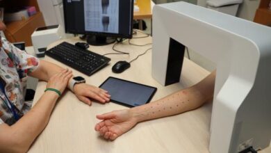 el-hospital-universitario-de-toledo-incorpora-una-nueva-herramienta-digital-para-la-lectura-de-las-pruebas-cutaneas-del-servicio-de-alergologia